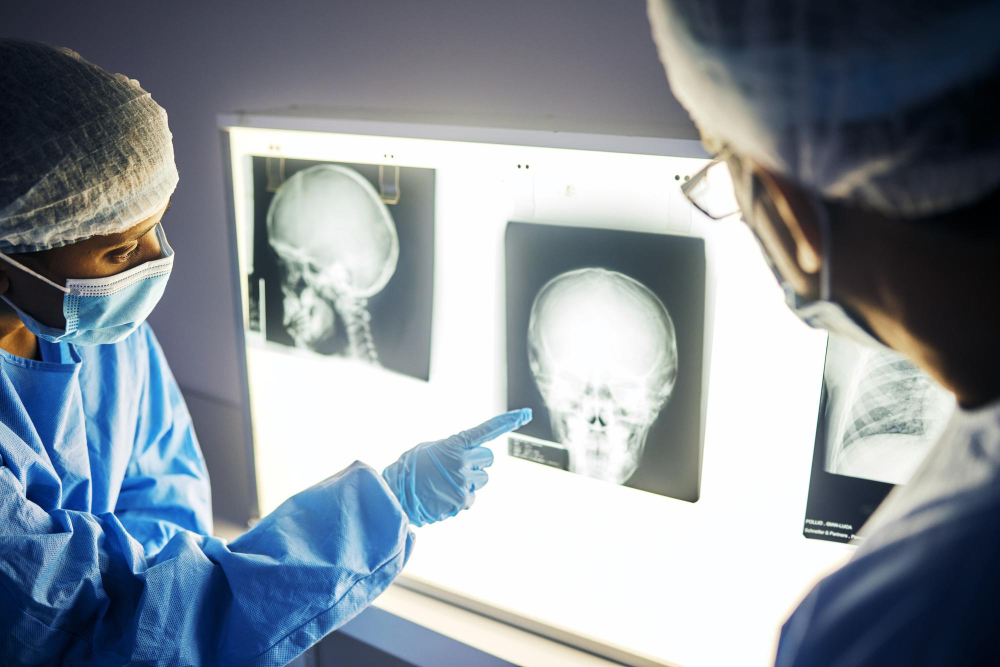Endoscopic Skull Base Surgery